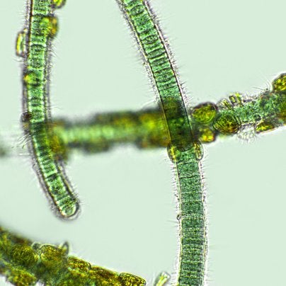 microscopic view of cyanobacteria